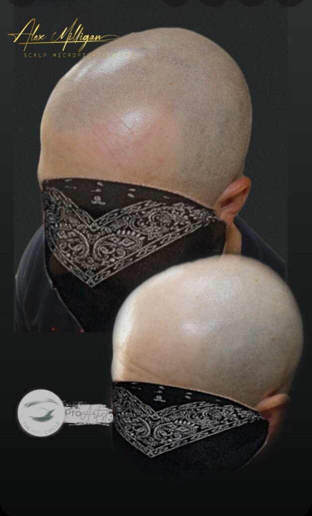 SCALP TATTOO - Alex Milligan SMP Bournemouth