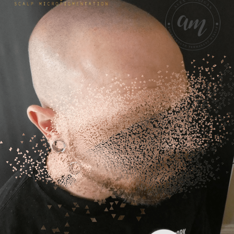 Scalp Tattoo Bournemouth - SCALP TATTOO BY Alex Milligan