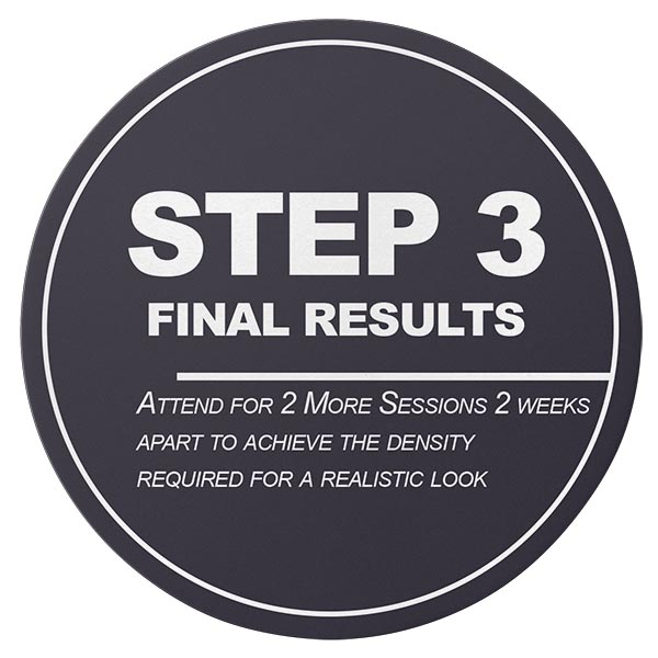 Scalp Tattoo Bournemouth - Step 3 - Final SMP Procedures