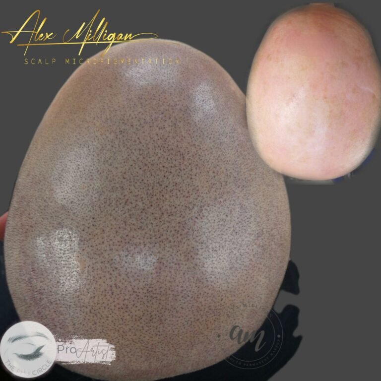 Top of Head Scalp Tattoo Bournemouth SMP